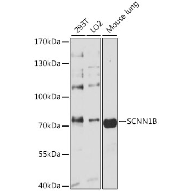 SCNN1B Rabbit Polyclonal Antibody