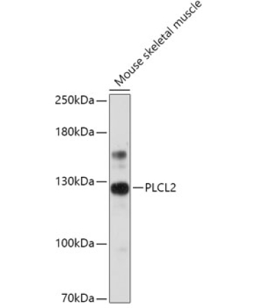 PLCL2 Rabbit Polyclonal Antibody