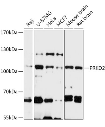 PRKD2 Rabbit Polyclonal Antibody