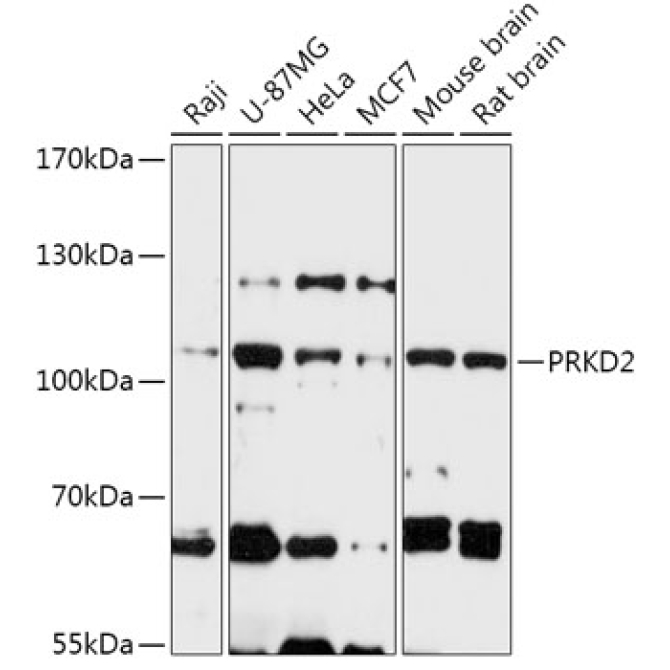 PRKD2 Rabbit Polyclonal Antibody