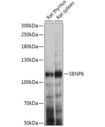 SENP6 Rabbit Polyclonal Antibody