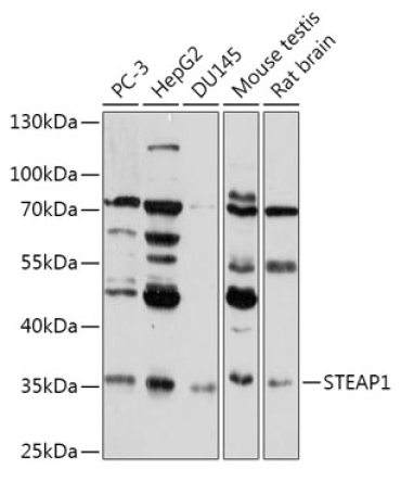 STEAP1 Rabbit Polyclonal Antibody