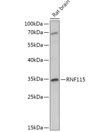 RNF115 Rabbit Polyclonal Antibody