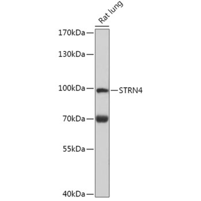 STRN4 Rabbit Polyclonal Antibody