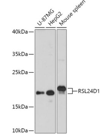 RSL24D1 Rabbit Polyclonal Antibody