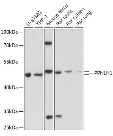 PPHLN1 Rabbit Polyclonal Antibody