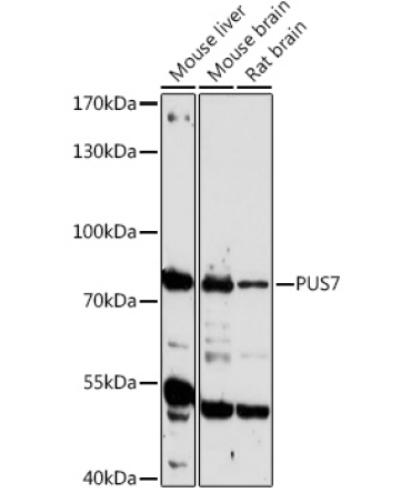 PUS7 Rabbit Polyclonal Antibody