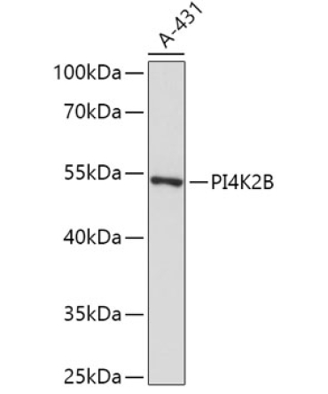 PI4K2B Rabbit Polyclonal Antibody