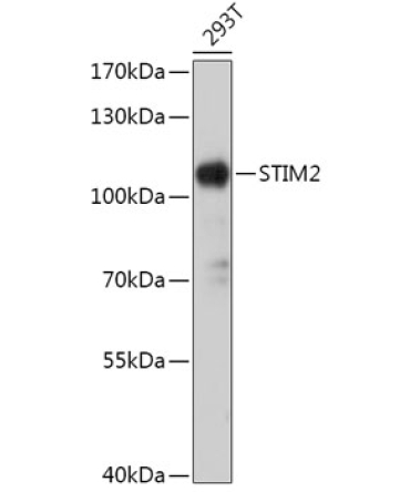 STIM2 Rabbit Polyclonal Antibody