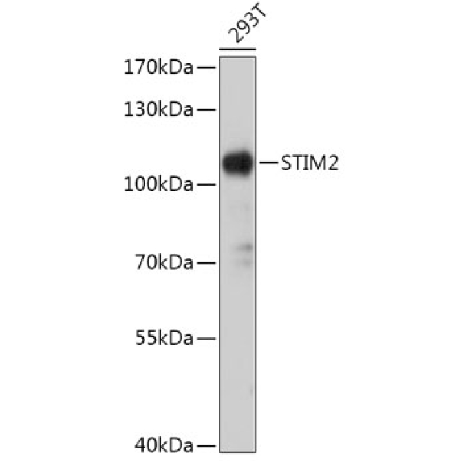 STIM2 Rabbit Polyclonal Antibody
