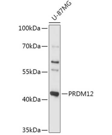 PRDM12 Rabbit Polyclonal Antibody