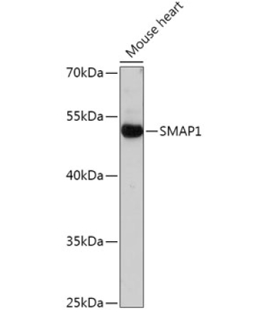 SMAP1 Rabbit Polyclonal Antibody