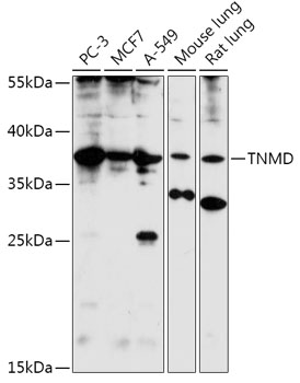 TNMD Rabbit Polyclonal Antibody
