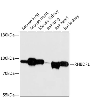 RHBDF1 Rabbit Polyclonal Antibody