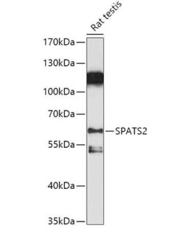SPATS2 Rabbit Polyclonal Antibody