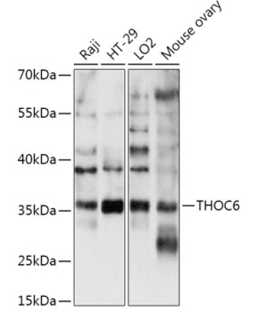 THOC6 Rabbit Polyclonal Antibody