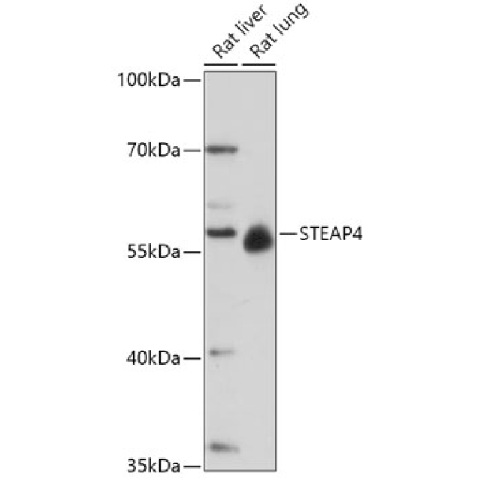 STEAP4 Rabbit Polyclonal Antibody