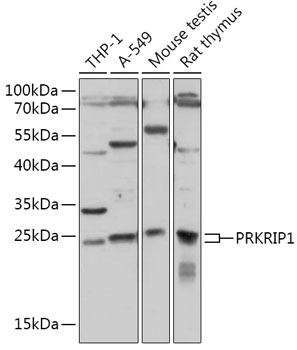 PRKRIP1 Rabbit Polyclonal Antibody
