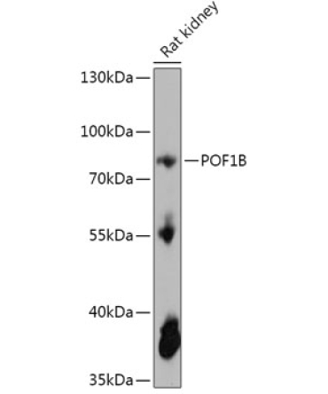 POF1B Rabbit Polyclonal Antibody