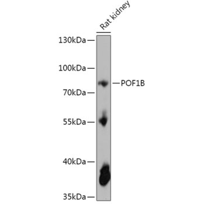 POF1B Rabbit Polyclonal Antibody