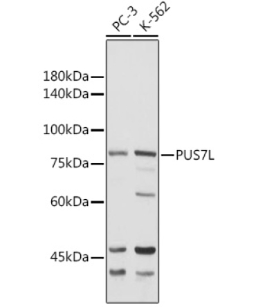 PUS7L Rabbit Polyclonal Antibody