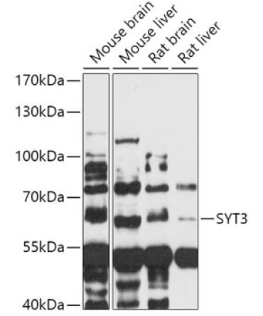 SYT3 Rabbit Polyclonal Antibody