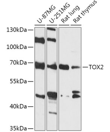 TOX2 Rabbit Polyclonal Antibody