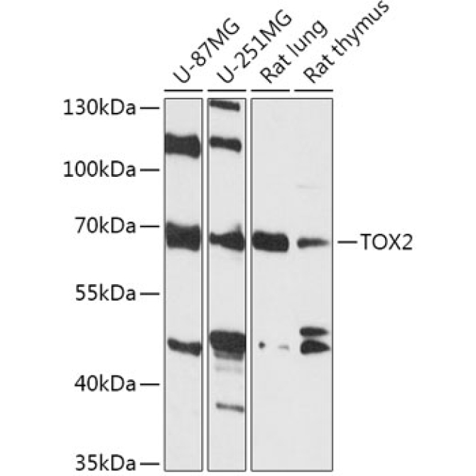 TOX2 Rabbit Polyclonal Antibody