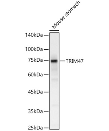 TRIM47 Rabbit Polyclonal Antibody