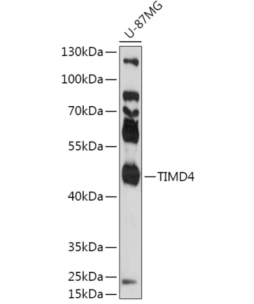 TIMD4 Rabbit Polyclonal Antibody