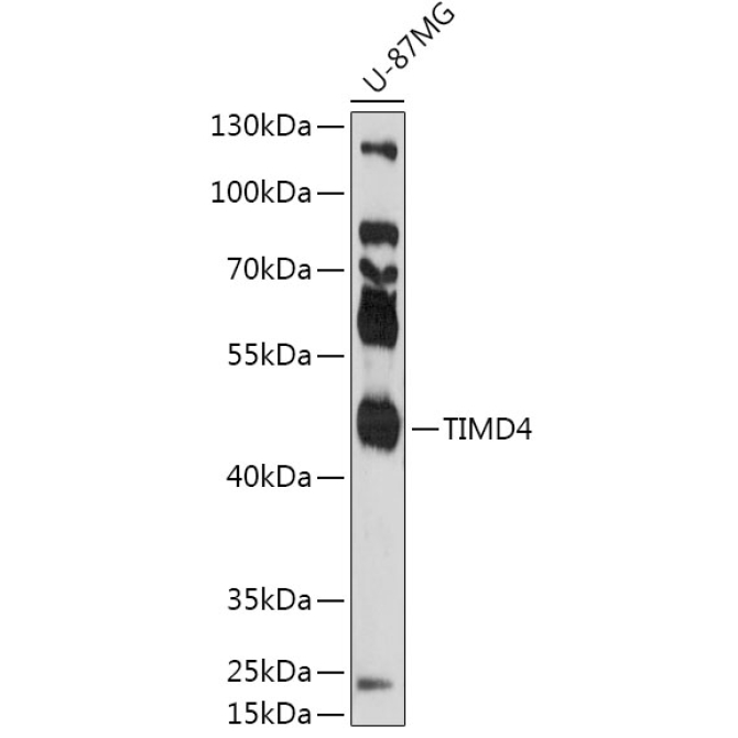 TIMD4 Rabbit Polyclonal Antibody