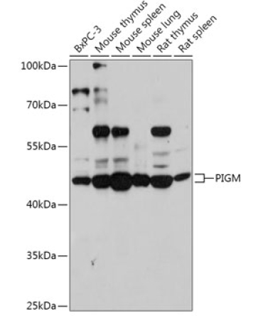 PIGM Rabbit Polyclonal Antibody