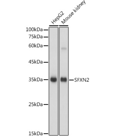 SFXN2 Rabbit Polyclonal Antibody
