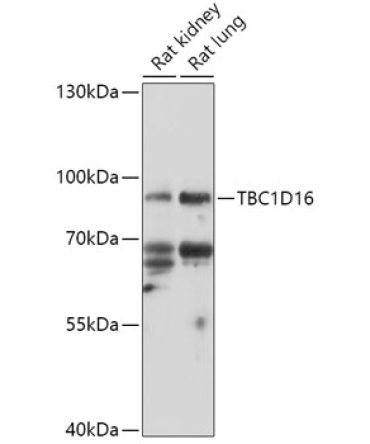 TBC1D16 Rabbit Polyclonal Antibody