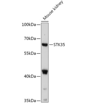 STK35 Rabbit Polyclonal Antibody