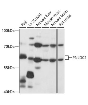 PNLDC1 Rabbit Polyclonal Antibody