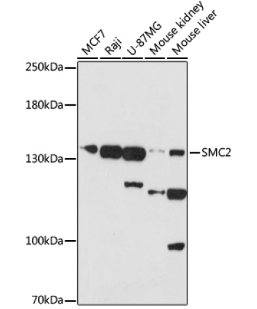SMC2 Rabbit Polyclonal Antibody