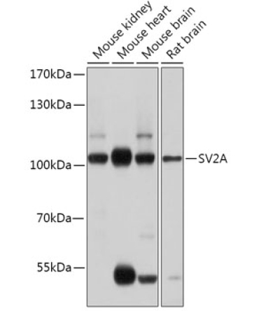 SV2A Rabbit Polyclonal Antibody