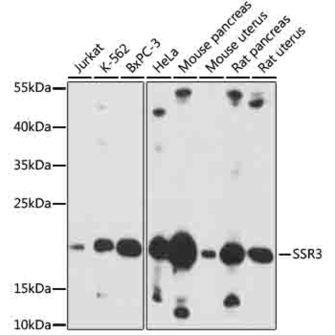 SSR3 Rabbit Polyclonal Antibody