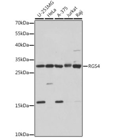 RGS4 Rabbit Polyclonal Antibody