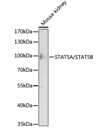 STAT5A/STAT5B Rabbit Polyclonal Antibody