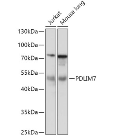 PDLIM7 Rabbit Polyclonal Antibody
