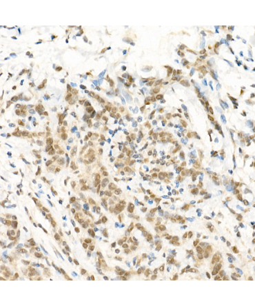 RGS2 Rabbit Polyclonal Antibody