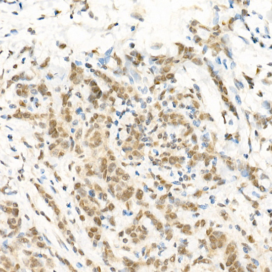 RGS2 Rabbit Polyclonal Antibody