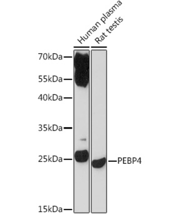 PEBP4 Rabbit Polyclonal Antibody
