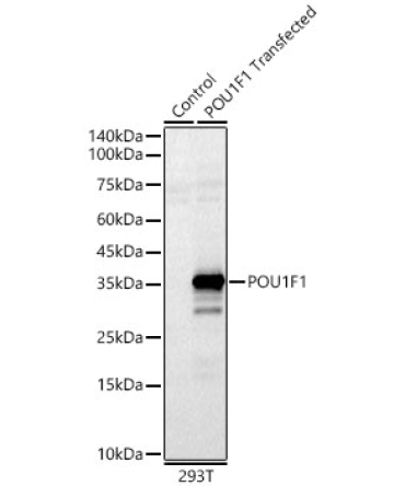 POU1F1 Rabbit Polyclonal Antibody