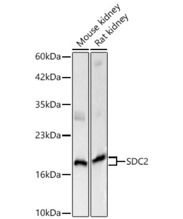 SDC2 Rabbit Polyclonal Antibody