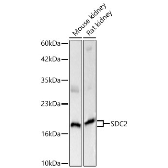 SDC2 Rabbit Polyclonal Antibody