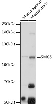 SMG5 Rabbit Polyclonal Antibody