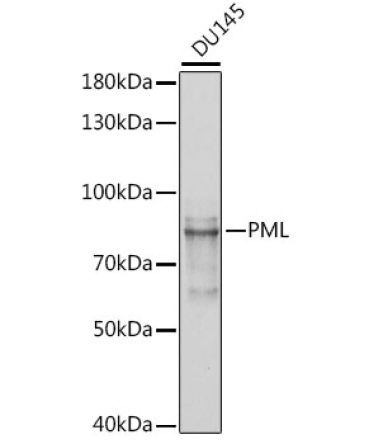 PML Rabbit Polyclonal Antibody